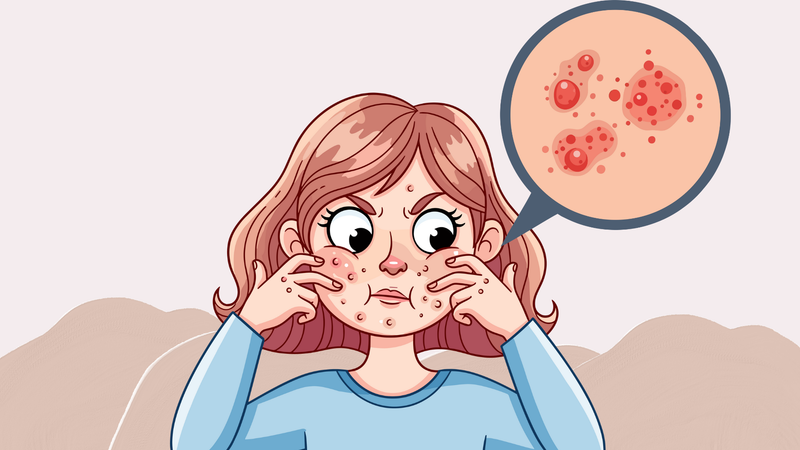 Rosacea Explained: Triggers, Skin Sensitivity, and Gentle Skincare Support