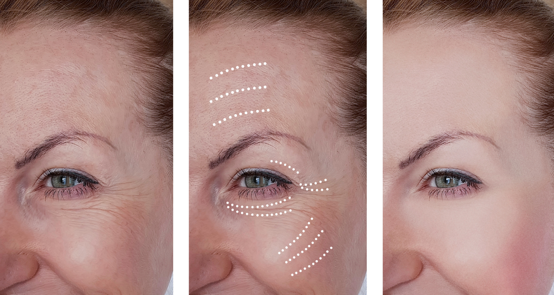 Why Your Skin Changes After 40 — And How to Support It Naturally